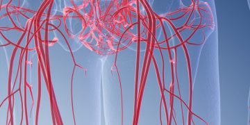 Vasculite ANCA-associata, rischio maggiore per chi risiede in aree rurali