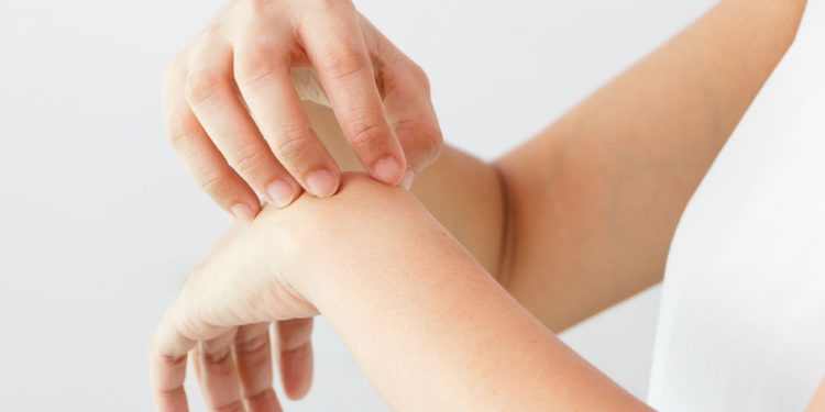 Malattie della pelle: diagnosticarle tramite foto sembra possibile