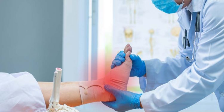 Artroplastica totale della caviglia: una soluzione contro il dolore in pazienti con artrite terminale