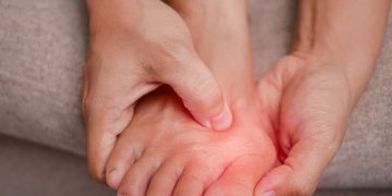 Alluce valgo: i consigli per alleviare il fastidio della “cipolla” al piede