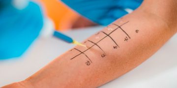 Nutraceutici: una soluzione nel controllo delle allergie