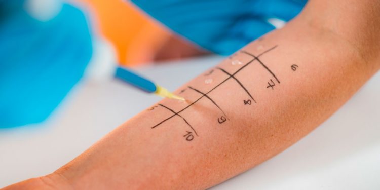 Nutraceutici: una soluzione nel controllo delle allergie