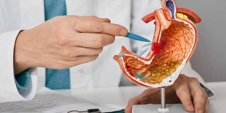 Ulcera perforata acuta: il drenaggio endoscopico è efficace e sicuro