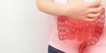 Malattia di Crohn: uno stile di vita salutare potrebbe prevenire fino al 60% dei casi