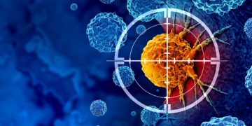 Studio Clinico Rivela l’Efficacia di una Nuova Terapia Immunologica nel Trattamento del Melanoma Metastatico: Implicazioni e Prospettive